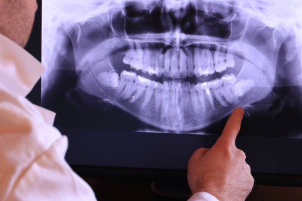 Best Knocked-Out Tooth Emergency  in Bladenboro, NC