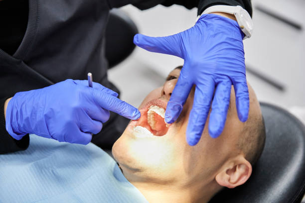 Best Teeth Whitening  in Bladenboro, NC